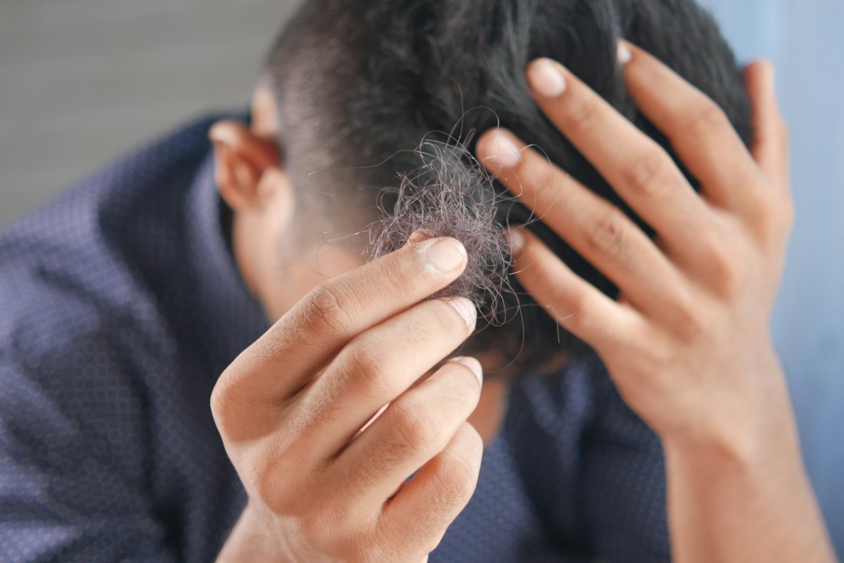 Thinning hair: treatment options that support regrowth