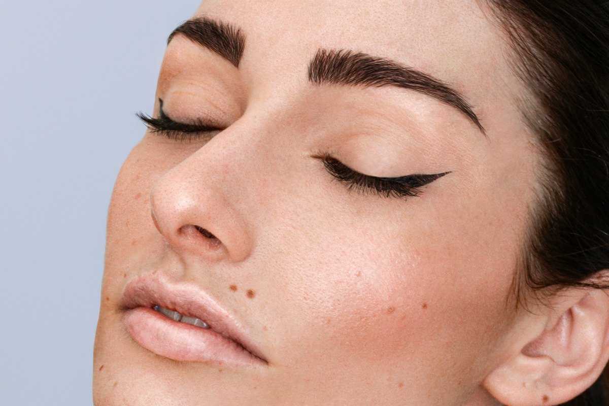 Hormonal acne in your 30s and 40s: why it happens