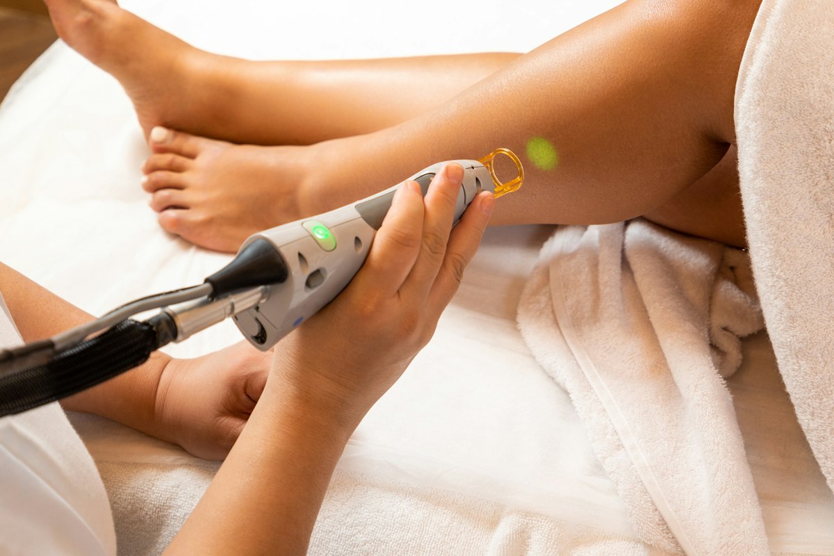 Why you need a patch test before laser hair removal