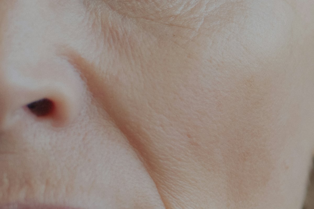 ZO Acne & Oil Control Facial for clients from Dervock