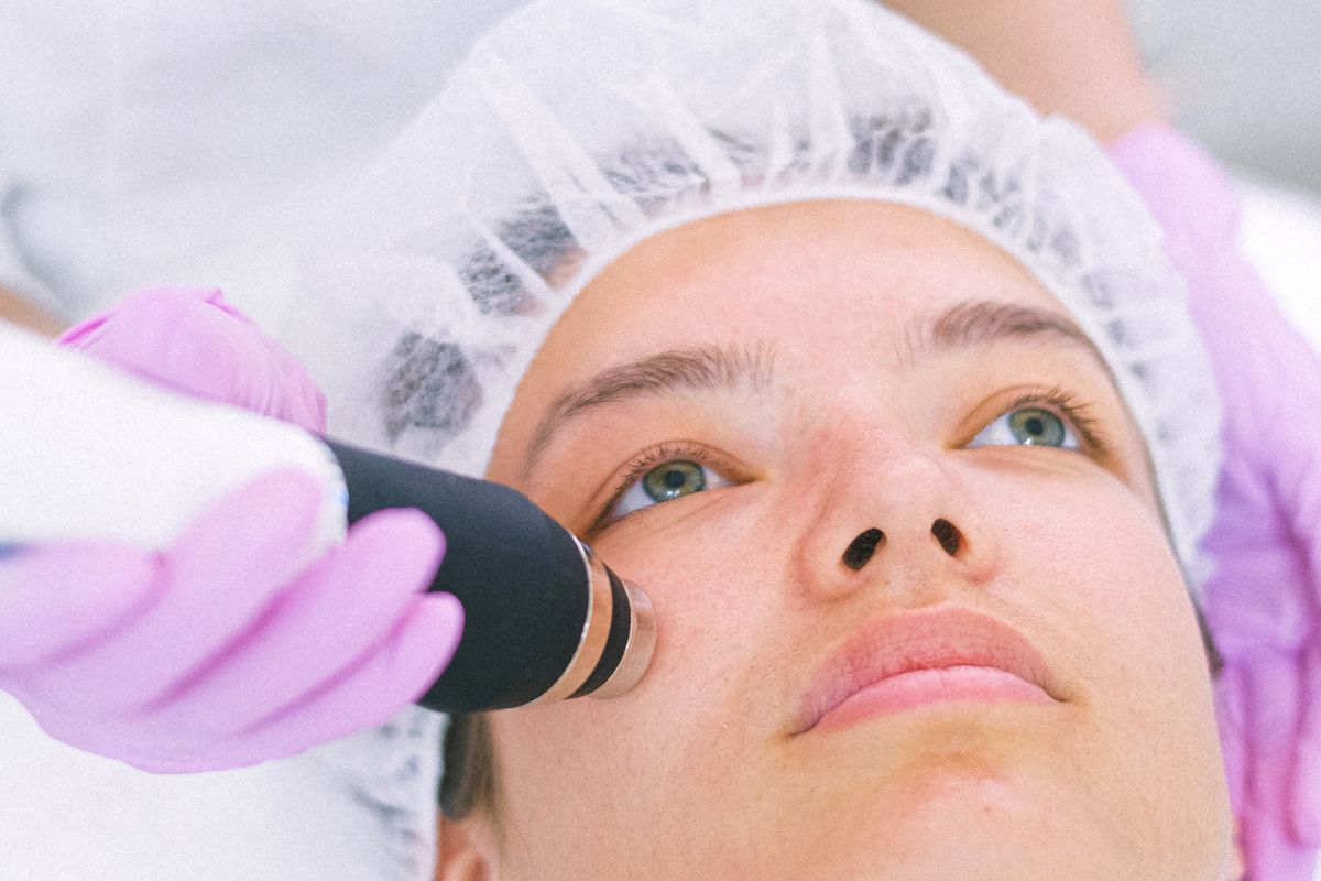 SkinPen Precision microneedling for clients from Newtownabbey