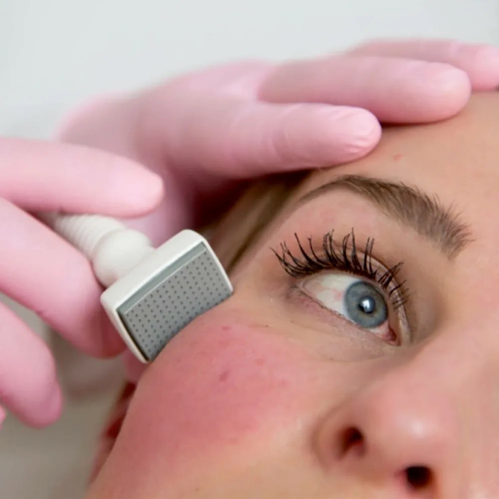 AQ GFIT growth factor treatment at Skin Deep Aesthetics