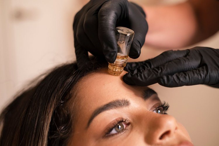 Aquagold Fine Touch at Skin Deep Aesthetics