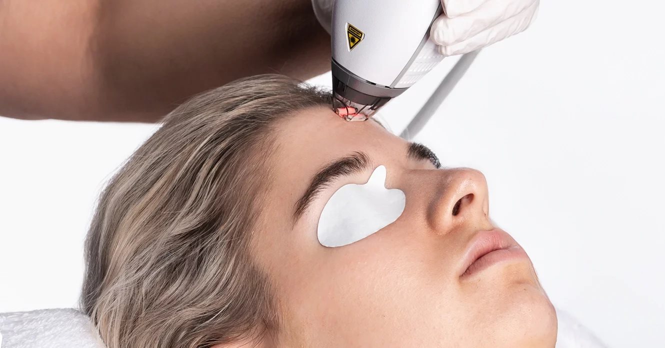 Clear + Brilliant laser at Skin Deep Aesthetics