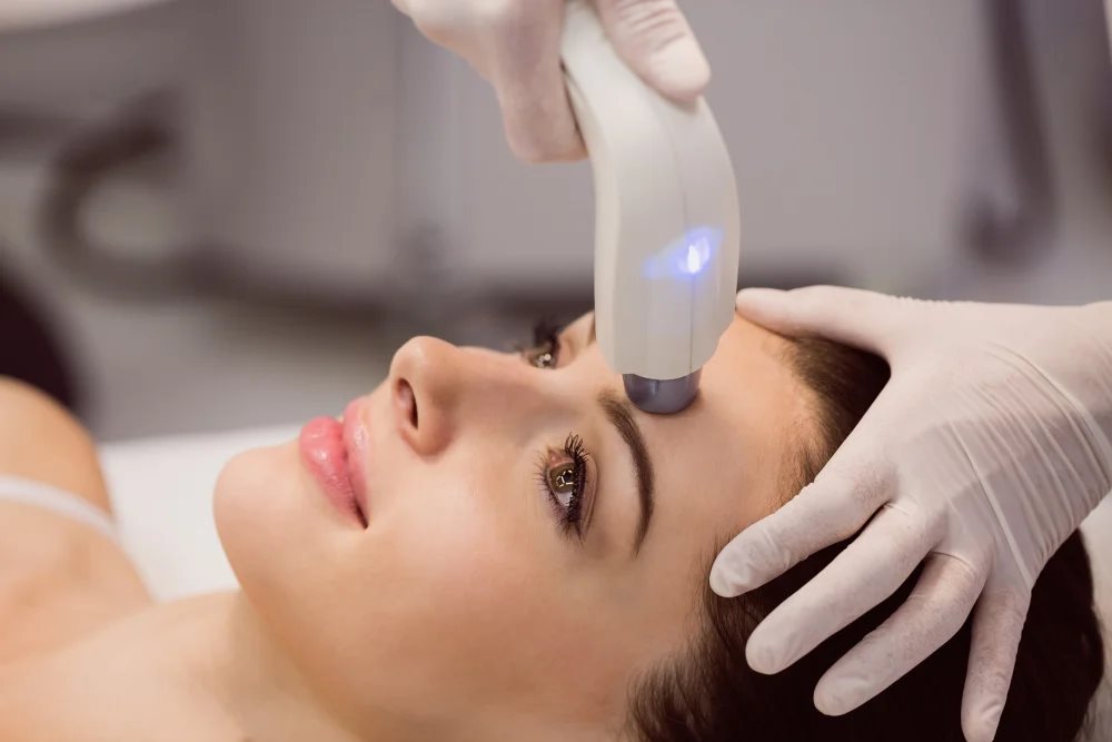 Laser pigmentation removal at Skin Deep Aesthetics
