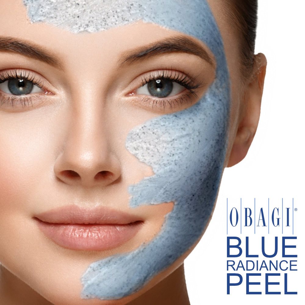 Obagi Blue Peel Radiance at Skin Deep Aesthetics
